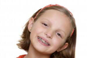 This image shows What is the best age for kids to have braces?