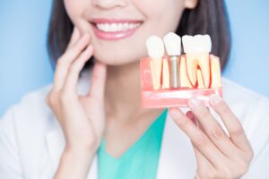 Why People Opt for Dental Implants