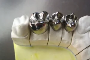 This image shows, care for dental crowns