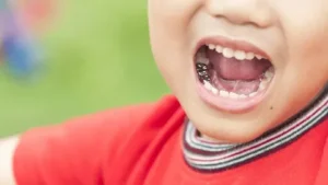 This image shows Types-of-Crowns-for-Kids